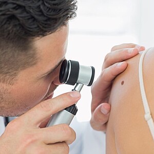 Consultatie dermatologie